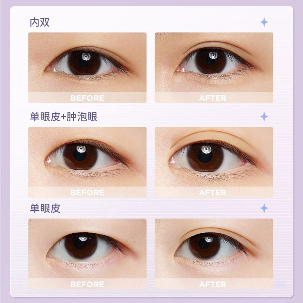 Everbab-Traceless-Eyelid-Stickers---S-Shape,-400-Pieces-1